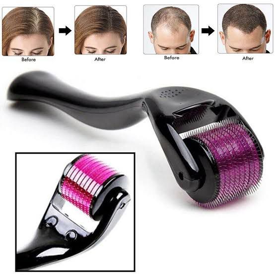 🌿✨ Titanium Derma Roller 0.5mm + Organic Hair Growth Oil – Complete Set